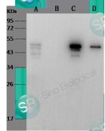 SARS-CoV/SARS-CoV-2 Nucleocapsid Antibody, Mouse MAb sinobiological 40143-MM08