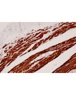 Anti-Human Myoglobin Antibody, Mouse MAb sinobiological IHC093