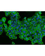 Anti-EGFR Antibody, Mouse Monoclonal sinobiological 10001-MM08T