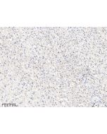 Anti-Cathepsin S Antibody, Rabbit Polyclonal sinobiological 10487-T26