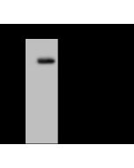 Anti-Chk1 Antibody, Rabbit Polyclonal sinobiological 10539-T52