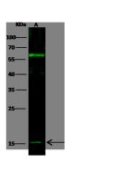 Anti-IFN-alpha 13 Antibody, Rabbit Polyclonal sinobiological 90108-T48