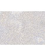 Anti-CRTAP Antibody, Rabbit Polyclonal sinobiological 201299-T10