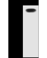 Anti-Alkaline Phosphatase/ALPL Antibody, Rabbit Polyclonal sinobiological 10440-T52