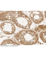 Anti-Argonaute 4/Ago4 Antibody, Rabbit Polyclonal sinobiological 100901-T08