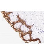 Anti-Cytokeratin 10 Antibody, Rabbit Polyclonal sinobiological 102250-T08