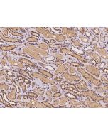 Anti-AZI2 Antibody, Rabbit Polyclonal sinobiological 200464-T08