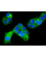 Anti-CD63 Antibody, Mouse Monoclonal sinobiological 11271-MM03