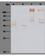 Ebola virus EBOV (subtype Zaire, strain Mayinga 1976) Glycoprotein / GP Antibody, Rabbit PAb, Antigen Affinity Purified sinobiological 40304-T46