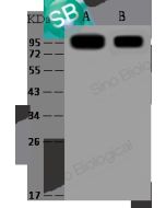 SARS-CoV Spike S1 Subunit Antibody, Mouse MAb sinobiological 40150-MM08