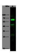 Anti-Interferon alpha/beta receptor 1 Antibody, Rabbit Polyclonal sinobiological 50469-RP01