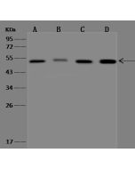 Anti-MMP13 Antibody, Rabbit Polyclonal sinobiological 310471-T40