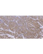 Anti-Human PR/Progesterone Receptor Antibody, Mouse MAb sinobiological IHC064