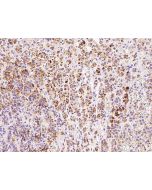 Anti-HDHD3 Antibody, Rabbit Polyclonal sinobiological 102665-T08