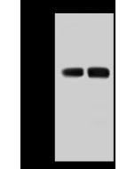 Anti-Acidic Calponin/CNN3 Antibody, Rabbit Polyclonal sinobiological 207861-T38