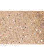 Anti-BACE1 Antibody, Rabbit Polyclonal sinobiological 50002-T56
