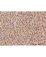 Anti-ADAM22 Antibody, Rabbit Polyclonal sinobiological 207194-T10