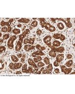 Anti-c-Abl/ABL1 Antibody, Rabbit Polyclonal sinobiological 11199-T26