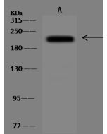 Anti-HEATR1 Antibody, Rabbit Polyclonal sinobiological 206574-T46