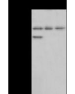 Anti-CPSF6 Antibody, Rabbit Polyclonal sinobiological 102954-T44