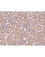 Anti-ADAM15 Antibody, Rabbit Polyclonal sinobiological 204241-T08