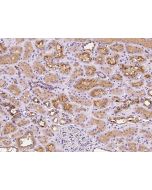 Anti-ATP6V1D/Atp6m Antibody, Rabbit Polyclonal sinobiological 200460-T08