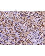 Anti-ANKRD30B Antibody, Rabbit Polyclonal sinobiological 204515-T08