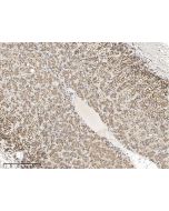 Anti-Cathepsin D Antibody, Rabbit Polyclonal sinobiological 12517-T24