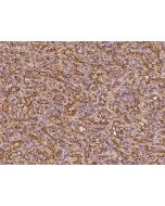 Anti-BTN3A3 Antibody, Rabbit Polyclonal sinobiological 204065-T08