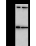 Anti-Endoglin/CD105 Antibody, Rabbit Polyclonal sinobiological 100558-T36