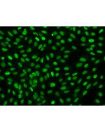 Anti-FAM111B Antibody, Rabbit Polyclonal sinobiological 204389-T02