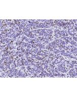 Anti-Ki67/MKI67 Antibody, Mouse Monoclonal sinobiological 100130-MM21