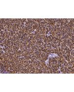 Anti-S100B Antibody, Mouse Monoclonal sinobiological 100508-MM03
