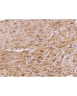 Anti-CAMK2D/CaMKII Delta Antibody, Rabbit Polyclonal sinobiological 203615-T08