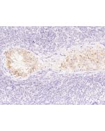Anti-MIS/AMH Antibody, Mouse Monoclonal sinobiological 17500-MM14
