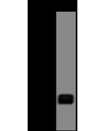 Anti-CNBP Antibody, Rabbit Polyclonal sinobiological 207092-T36