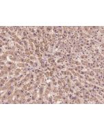 Anti-CHMP2A Antibody, Rabbit Polyclonal sinobiological 200839-T08