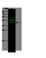 Anti-ARHGAP28 Antibody, Rabbit Polyclonal sinobiological 102812-T40