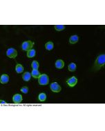 Anti-B7-H3 Antibody, Mouse Monoclonal sinobiological 11188-MM06