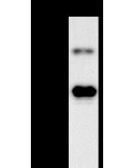 Monkeypox Virus (MPXV) Envelope protein E8L Antibody, Mouse MAb sinobiological 40890-MM16