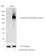 Phospho-EGF Receptor (Tyr1173) Antibody, Rabbit MAb sinobiological 110844-R0002