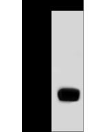 Anti-BLVRB Antibody, Rabbit Polyclonal sinobiological 13151-T48