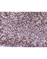 Anti-Carbonic Anhydrase IX/CA9 Antibody, Rabbit Polyclonal sinobiological 50660-T24
