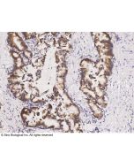 Anti-ABHD1 Antibody, Rabbit Polyclonal sinobiological 102778-T08