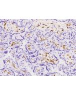 Anti-Factor XIIIa Antibody, Rabbit Polyclonal sinobiological 203119-T08