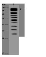 Anti-DLGAP5 Antibody, Rabbit Polyclonal sinobiological 203823-T36