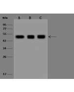Anti-AARSD1 Antibody, Rabbit Polyclonal sinobiological 201256-T36