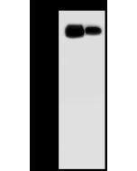 Anti-CD166/ALCAM Antibody, Rabbit Polyclonal sinobiological 201409-T32