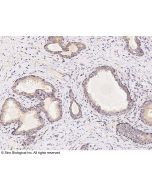 Anti-GABARAPL2 Antibody, Rabbit Polyclonal sinobiological 14563-T24