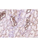 Anti-FXYD2 Antibody, Rabbit Polyclonal sinobiological 201892-T08